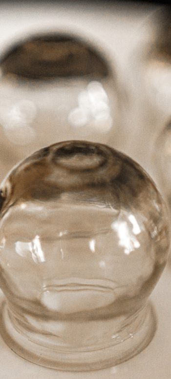 Cupping Cupping